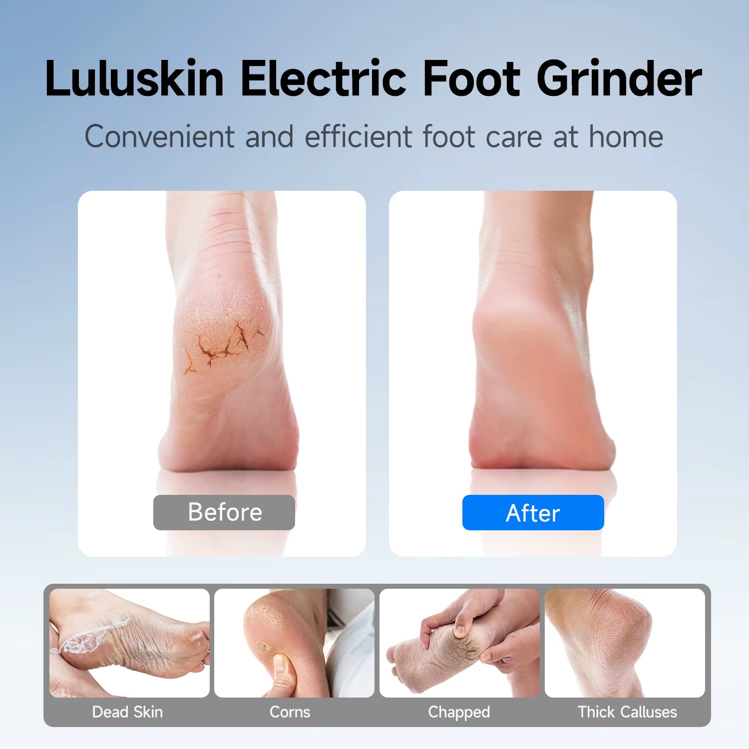Rechargeable Electric Foot Grinder USB Powered Callus Remover with Adjustable 3 Speeds for Men & Women'S Pedicure and Self-Care